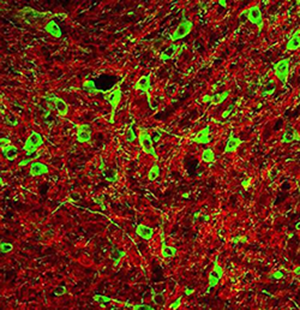 Stained dopamine neurons in the reward circuit
